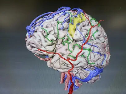 دكتور ي.فليسي جراحة المخ و الاعصاب Dr. FELISSI Neurochirurgien