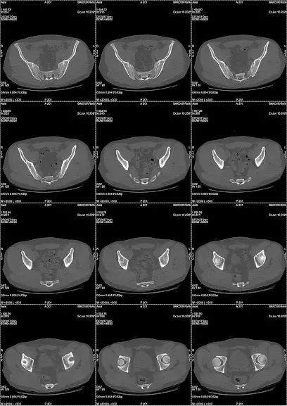 Dr Brahimi Orthopédiste