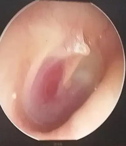 Dr Boutalbi ORL otolaryngology إختصاصي اذن انف و حنجرة تزي وزو طب
